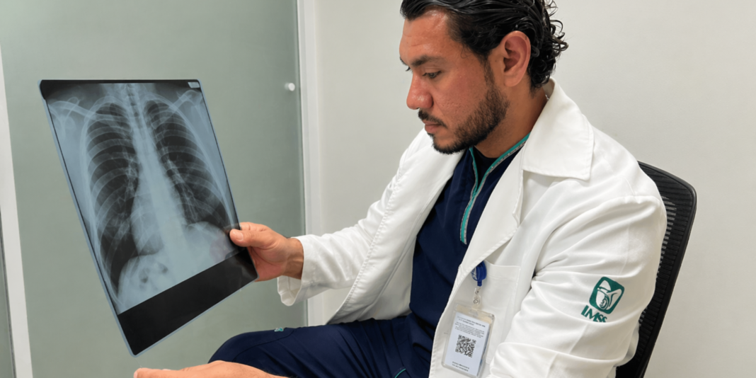 México registra un bebé con fibrosis quística por cada 10 mil recién nacidos